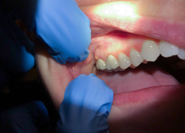 Best Emergency Cosmetic Dentistry in Hidden Meadows, CA